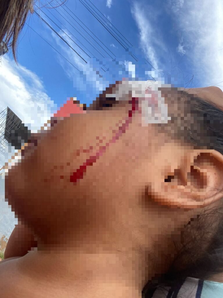 WhatsApp-Image-2025-03-04-at-18.03.18-768x1024 Guarda Municipal prende mulher de 24 anos acusada de maus-tratos contra a própria filha de três anos.