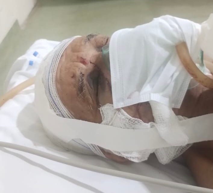 4f8b5e3c-d20b-4c1a-9652-4c4f3ffb02f1-2 Crime brutal em Várzea Grande: idoso é atacado a facão e família se revolta após suspeito confessar e ser liberado