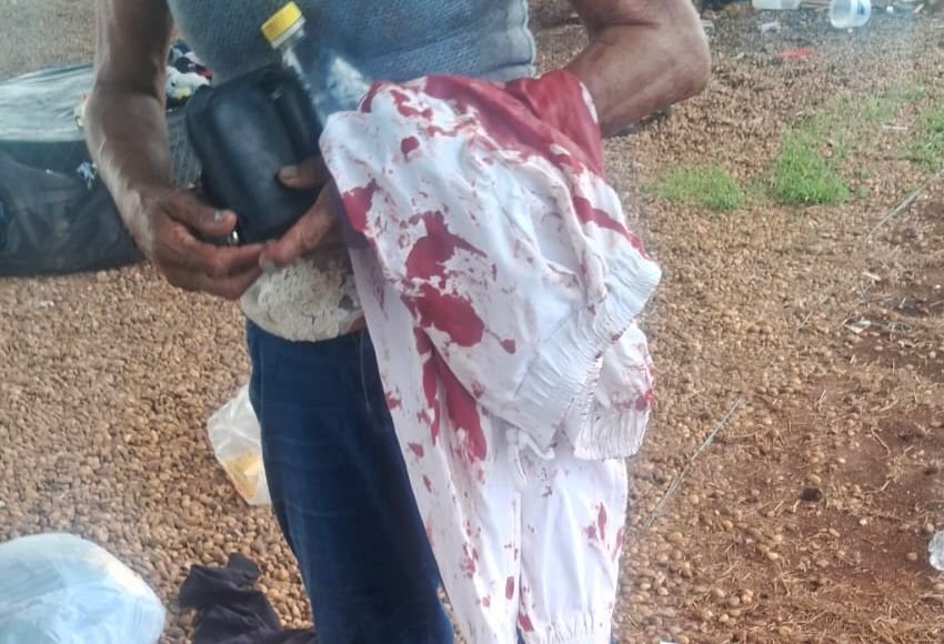 1000772648 Homem tenta matar companheira sob viaduto e é preso em flagrante pela PM em Cuiabá